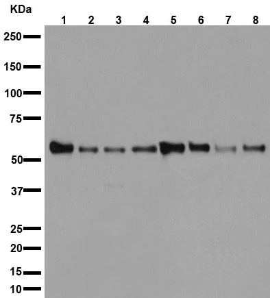 Western blot - Anti-AKT1 + AKT2 + AKT3 antibody [EPR16798] (AB179463)