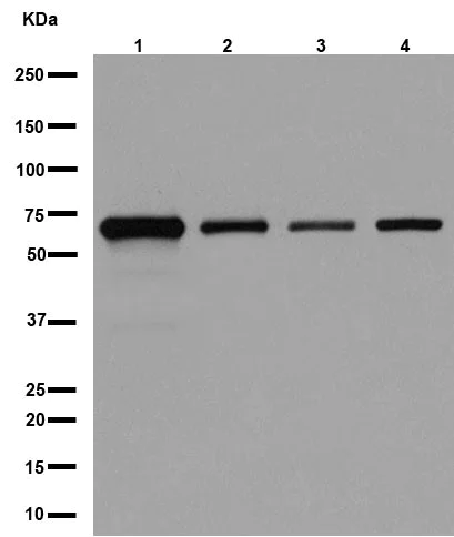 Western blot - Anti-AKT1 + AKT2 + AKT3 antibody [EPR16798] (AB179463)