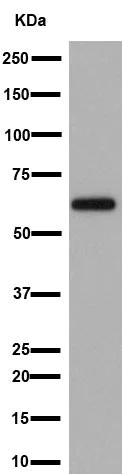 Western blot - Anti-AKT1 + AKT2 + AKT3 antibody [EPR16798] (AB179463)