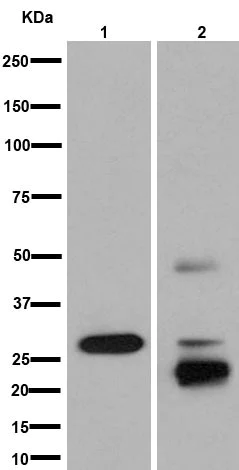 Western blot - Anti-AKT1 + AKT2 + AKT3 antibody [EPR16798] (AB179463)