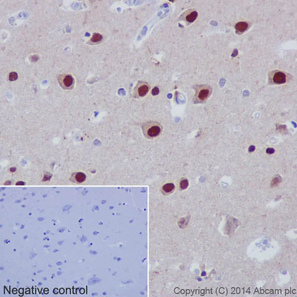 Immunohistochemistry (Formalin/PFA-fixed paraffin-embedded sections) - Anti-AKT1 + AKT2 + AKT3 antibody [EPR17671] (AB185633)
