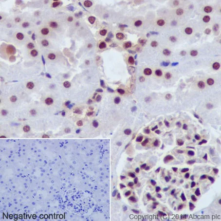 Immunohistochemistry (Formalin/PFA-fixed paraffin-embedded sections) - Anti-AKT1 + AKT2 + AKT3 antibody [EPR17671] (AB185633)