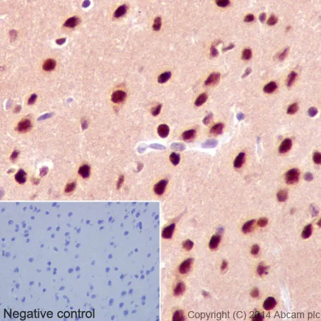 Immunohistochemistry (Formalin/PFA-fixed paraffin-embedded sections) - Anti-AKT1 + AKT2 + AKT3 antibody [EPR17671] (AB185633)