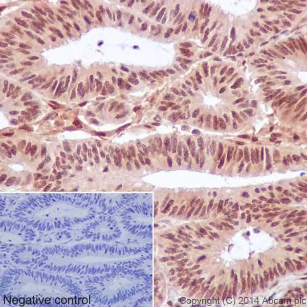 Immunohistochemistry (Formalin/PFA-fixed paraffin-embedded sections) - Anti-AKT1 + AKT2 + AKT3 antibody [EPR17671] (AB185633)