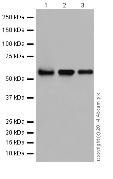 Western blot - Anti-AKT1 + AKT2 + AKT3 antibody [EPR17671] (AB185633)