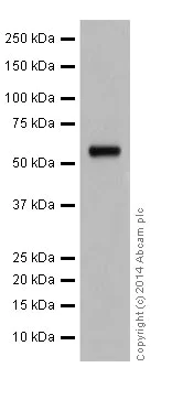 Western blot - Anti-AKT1 + AKT2 + AKT3 antibody [EPR17671] (AB185633)