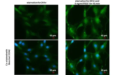 Immunocytochemistry/ Immunofluorescence - Anti-AKT1 + AKT2 + AKT3 (phospho S472 + S473 + S474) antibody (AB183758)