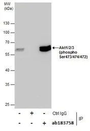 Immunoprecipitation - Anti-AKT1 + AKT2 + AKT3 (phospho S472 + S473 + S474) antibody (AB183758)