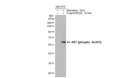 Western blot - Anti-AKT1 + AKT2 + AKT3 (phospho S472 + S473 + S474) antibody (AB183758)