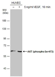Western blot - Anti-AKT1 + AKT2 + AKT3 (phospho S472 + S473 + S474) antibody (AB183758)