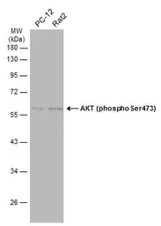 Western blot - Anti-AKT1 + AKT2 + AKT3 (phospho S472 + S473 + S474) antibody (AB183758)