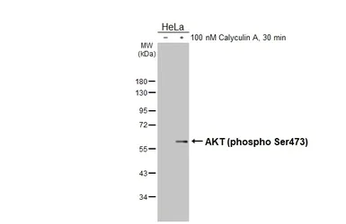 Western blot - Anti-AKT1 + AKT2 + AKT3 (phospho S472 + S473 + S474) antibody (AB183758)