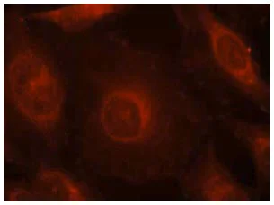 Immunocytochemistry/ Immunofluorescence - Anti-AKT1 + AKT2 + AKT3 (phospho Y312 + Y315 + Y316) antibody (AB131443)