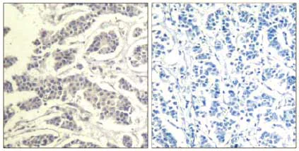 Immunohistochemistry (Formalin/PFA-fixed paraffin-embedded sections) - Anti-AKT1 + AKT2 + AKT3 (phospho Y312 + Y315 + Y316) antibody (AB131443)
