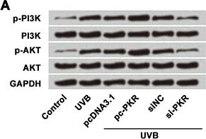 Western blot - Anti-AKT1 + AKT2 + AKT3 (phospho Y312 + Y315 + Y316) antibody (AB131443)