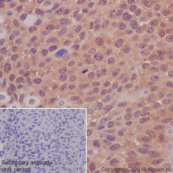 Immunohistochemistry (Formalin/PFA-fixed paraffin-embedded sections) - Anti-AKT1 + AKT2 antibody [EPR17062] - BSA and Azide free (AB250634)