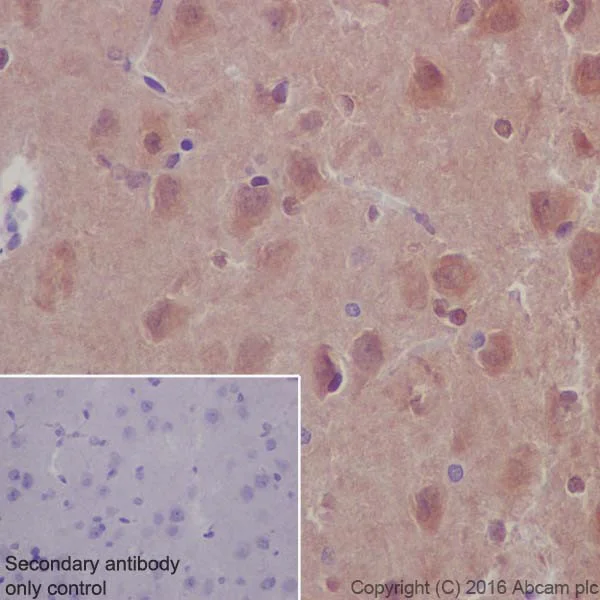 Immunohistochemistry (Formalin/PFA-fixed paraffin-embedded sections) - Anti-AKT1 + AKT2 antibody [EPR17062] - BSA and Azide free (AB250634)