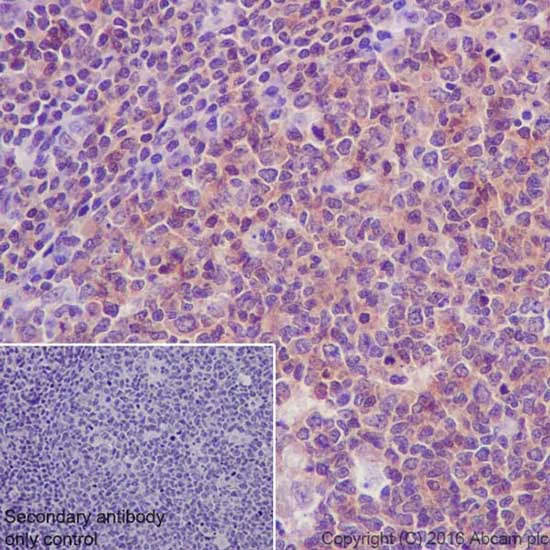 Immunohistochemistry (Formalin/PFA-fixed paraffin-embedded sections) - Anti-AKT1 + AKT2 antibody [EPR17062] - BSA and Azide free (AB250634)