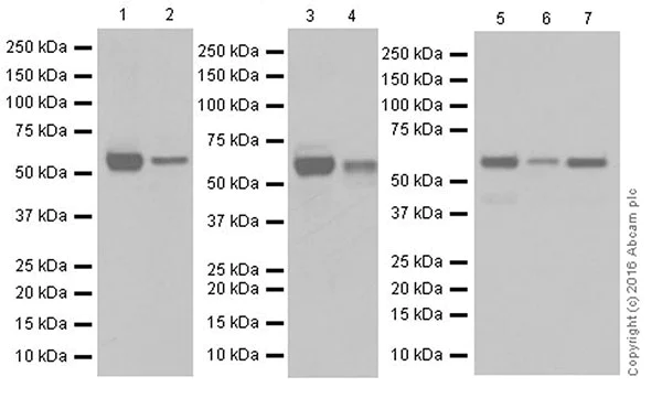 Western blot - Anti-AKT1 + AKT2 antibody [EPR17062] - BSA and Azide free (AB250634)