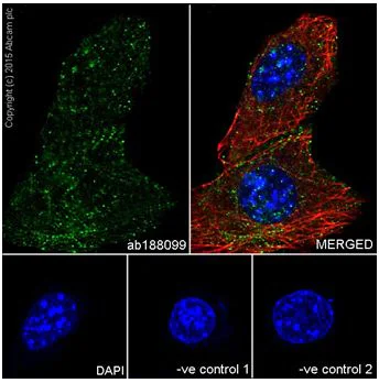 Immunocytochemistry/ Immunofluorescence - Anti-AKT1 + AKT2 antibody [EPR18405] - BSA and Azide free (AB238944)