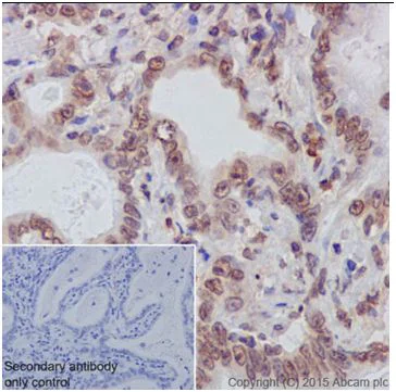 Immunohistochemistry (Formalin/PFA-fixed paraffin-embedded sections) - Anti-AKT1 + AKT2 antibody [EPR18405] - BSA and Azide free (AB238944)