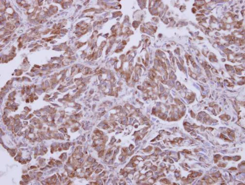 Immunohistochemistry (Formalin/PFA-fixed paraffin-embedded sections) - Anti-AKT1 antibody (AB227385)