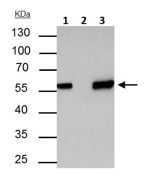 Immunoprecipitation - Anti-AKT1 antibody (AB227385)