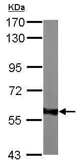 Western blot - Anti-AKT1 antibody (AB227385)