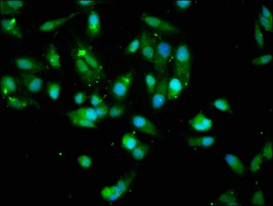 Immunocytochemistry/ Immunofluorescence - Anti-AKT1 antibody (AB235958)