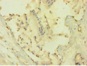 Immunohistochemistry (Formalin/PFA-fixed paraffin-embedded sections) - Anti-AKT1 antibody (AB235958)