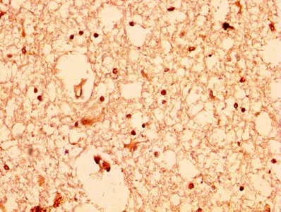 Immunohistochemistry (Formalin/PFA-fixed paraffin-embedded sections) - Anti-AKT1 antibody (AB235958)