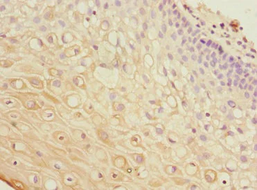 Immunohistochemistry (Formalin/PFA-fixed paraffin-embedded sections) - Anti-AKT1 antibody (AB235958)