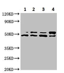 Western blot - Anti-AKT1 antibody (AB235958)