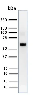 Western blot - Anti-AKT1 antibody [AKT1/2552] (AB237994)