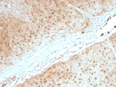 Immunohistochemistry (Formalin/PFA-fixed paraffin-embedded sections) - Anti-AKT1 antibody [AKT1/2552] - BSA and Azide free (AB237836)