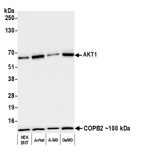 Western blot - Anti-AKT1 antibody [BLR245L] (AB314110), expandable thumbnail
