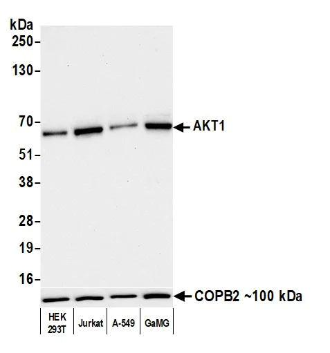 Western blot - Anti-AKT1 antibody [BLR245L] (AB314110)