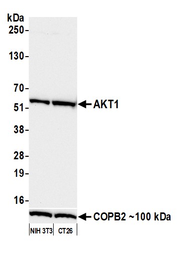 Western blot - Anti-AKT1 antibody [BLR245L] (AB314110), expandable thumbnail
