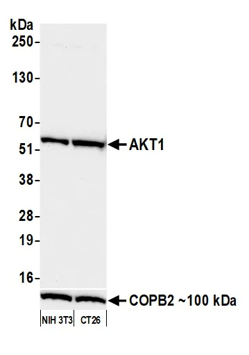 Western blot - Anti-AKT1 antibody [BLR245L] (AB314110)