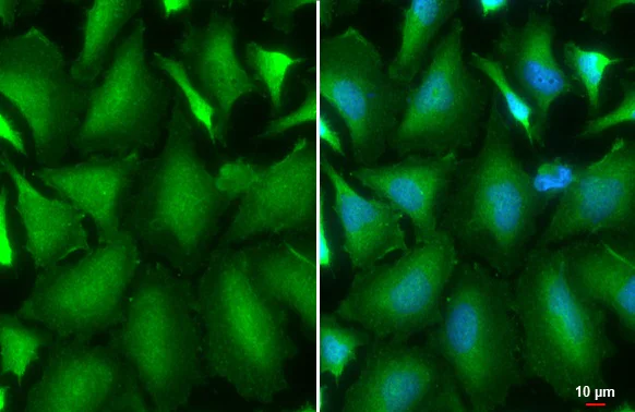 Immunocytochemistry/ Immunofluorescence - Anti-AKT1 antibody [HL1142] (AB308343)