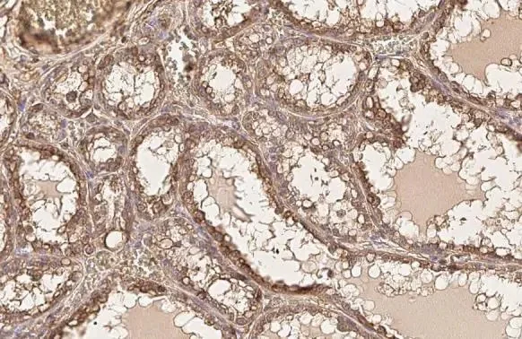Immunohistochemistry (Formalin/PFA-fixed paraffin-embedded sections) - Anti-AKT1 antibody [HL1142] (AB308343)