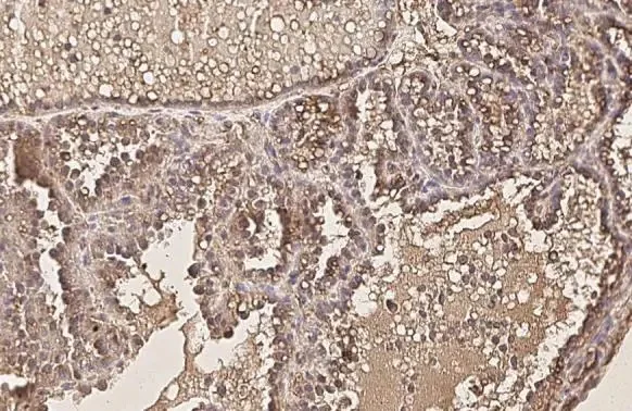 Immunohistochemistry (Formalin/PFA-fixed paraffin-embedded sections) - Anti-AKT1 antibody [HL1142] (AB308343)