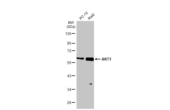 Western blot - Anti-AKT1 antibody [HL1142] (AB308343)