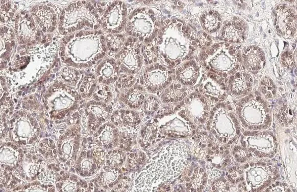 Immunohistochemistry (Formalin/PFA-fixed paraffin-embedded sections) - Anti-AKT1 antibody [HL1145] - BSA and Azide free (AB308381)