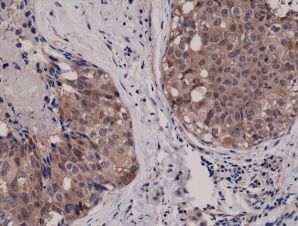 Immunohistochemistry (Formalin/PFA-fixed paraffin-embedded sections) - Anti-AKT1 antibody [RM252] (AB238477), expandable thumbnail