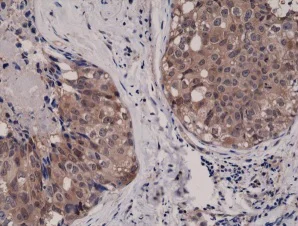 Immunohistochemistry (Formalin/PFA-fixed paraffin-embedded sections) - Anti-AKT1 antibody [RM252] (AB238477)