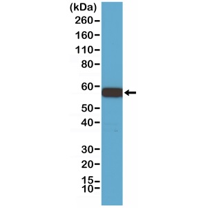 Western blot - Anti-AKT1 antibody [RM252] (AB238477), expandable thumbnail