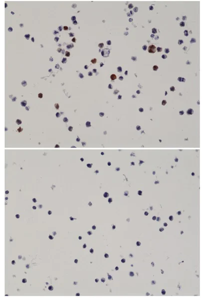 Immunohistochemistry (Formalin/PFA-fixed paraffin-embedded sections) - Anti-AKT1 (mutated E17K) antibody [RM336] (AB238304)