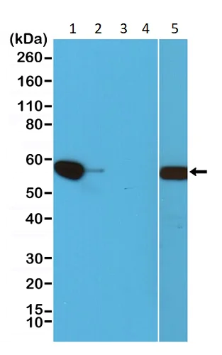 Western blot - Anti-AKT1 (mutated E17K) antibody [RM336] (AB238304)