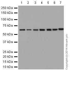 Western blot - Anti-AKT1 (phospho S124) antibody [EPR17680] (AB183556)